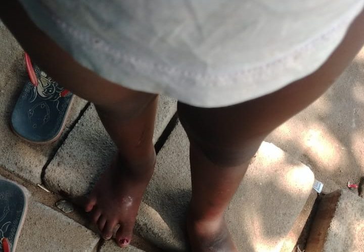 ଜନ୍ମକଲା ମାଆର ଅମାନୁଷିକ ଅତ୍ୟାଚାର, ୩ ବର୍ଷର ଝିଅକୁ ମାଡ ମାରିବା ସହ ଚେଙ୍କ ଦେଲା ଜନ୍ମକଲା ମାଆ